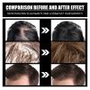 OUHOE Liquid Biotin & Collagen Hair Growth Drops