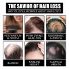 OUHOE Liquid Biotin & Collagen Hair Growth Drops